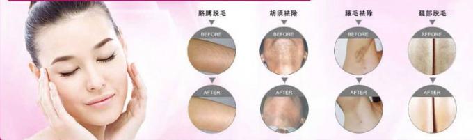 Facotry の価格 2013 最も新しい IPL の機械